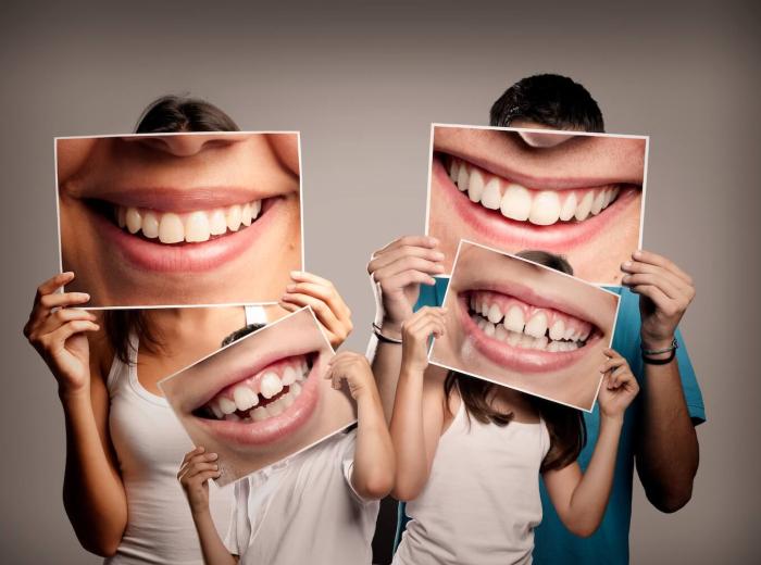 Black Triangle Closure in Beverly Hills: Non-Invasive Smile Enhancement at Comfy Dental Studios
