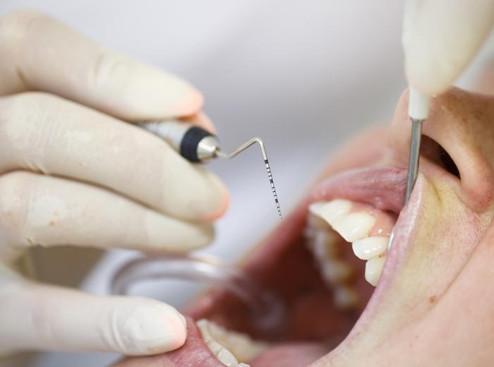 Gum Builder Treatment: Can You Rebuild Receding Gums?