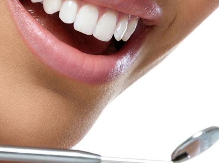 Cavity-Fighting Foods: What to Include in Your Diet