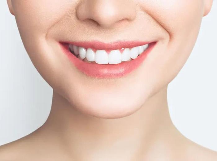 Achieving Your Perfect Smile
