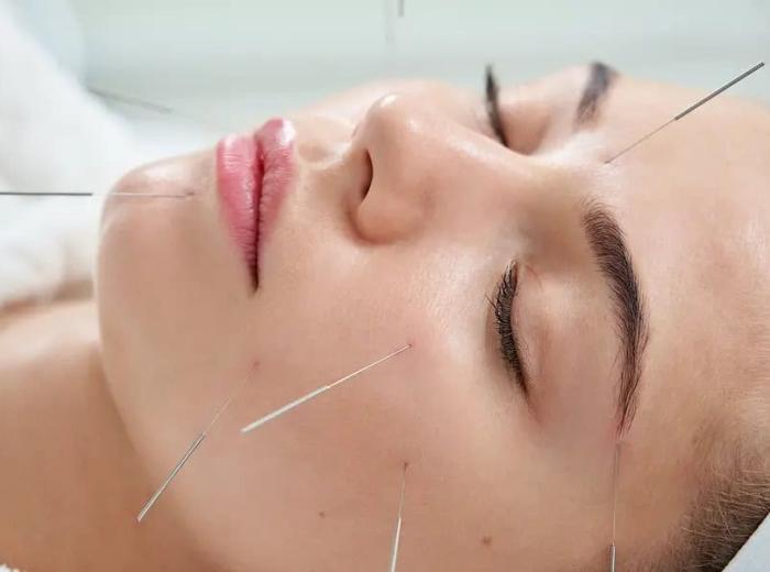 A Holistic Approach to Oral Health: Dental Acupuncture at Comfy Dental Studios